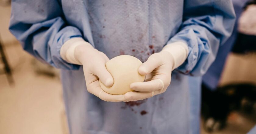 Influenciadora faz importante alerta ao descobrir câncer raro ligado a implante de silicone